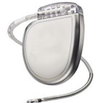 ICD device which is designed to restore a normal heartbeat if a dangerous arrhythmia is detected