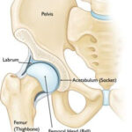Hamstring Injury Prevention