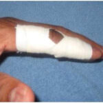 Finger Taping