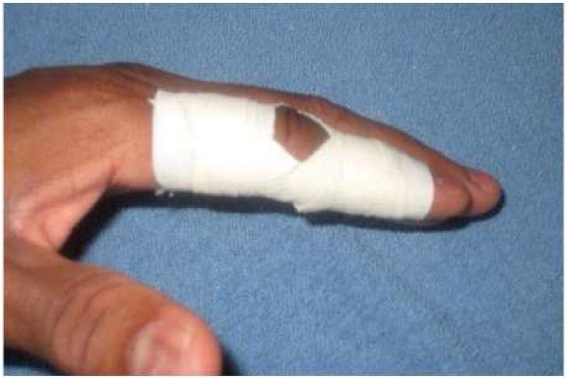 Finger Taping
