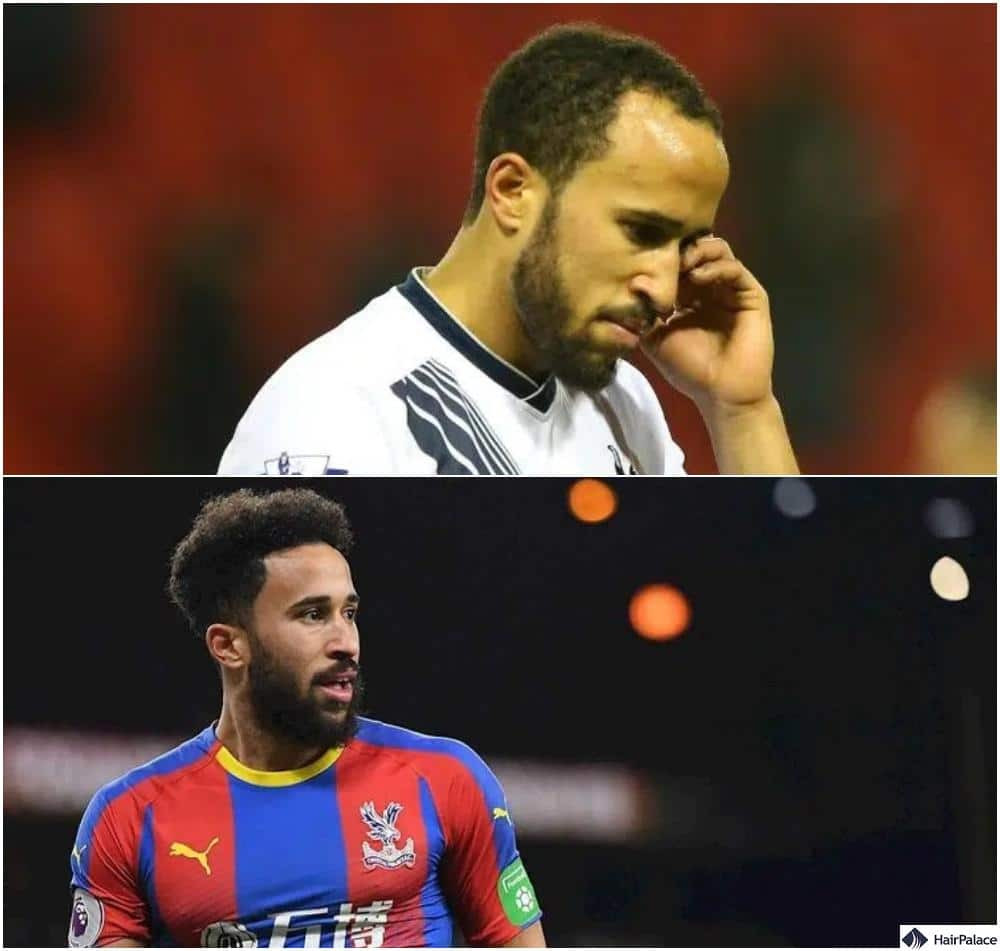 Andros Townsend showcasing his restored hairline