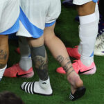 Lionel Messi Ankle Injury
