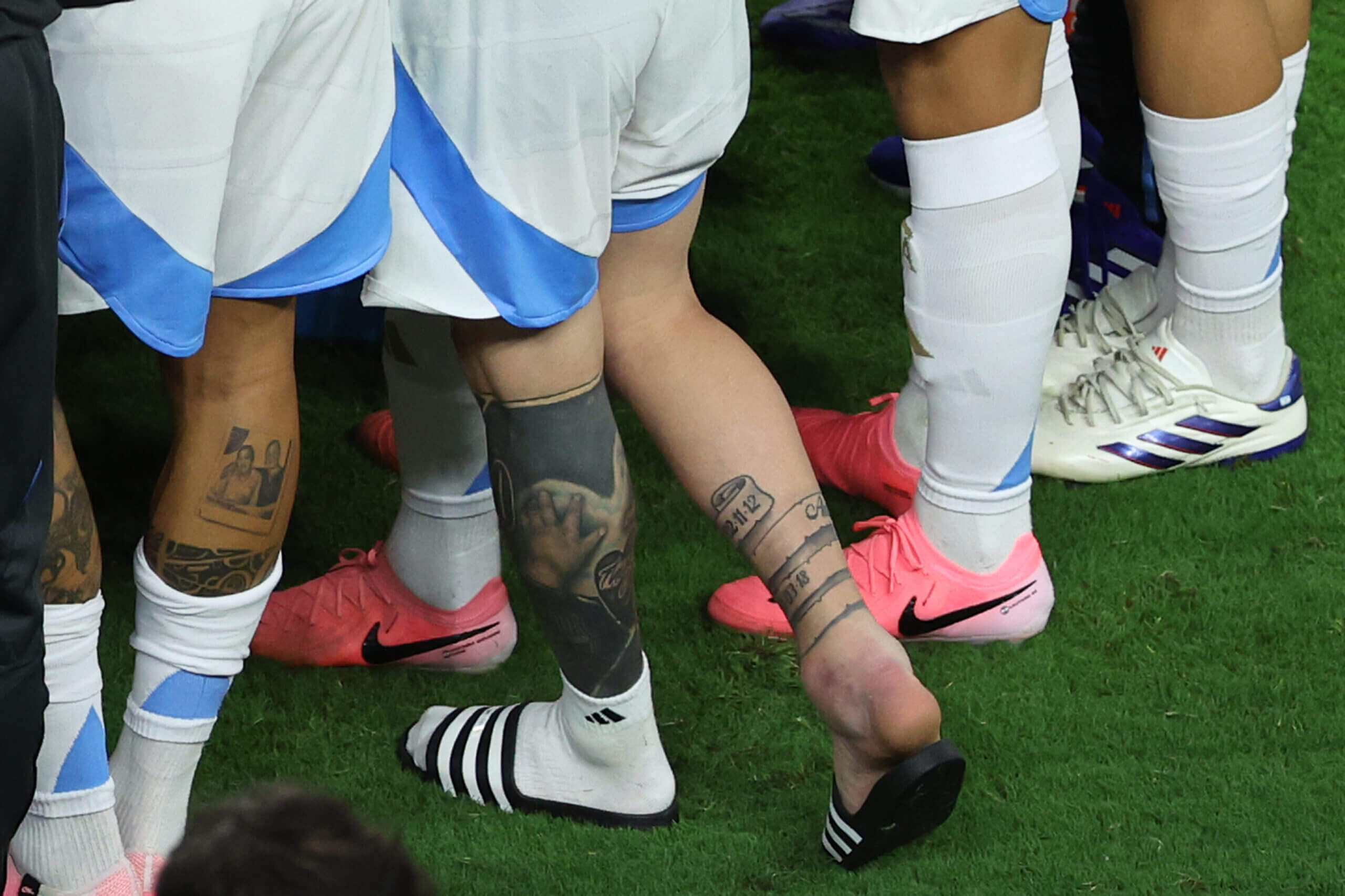Lionel Messi Ankle Injury